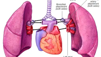 Medical team performing a lung removal surgery