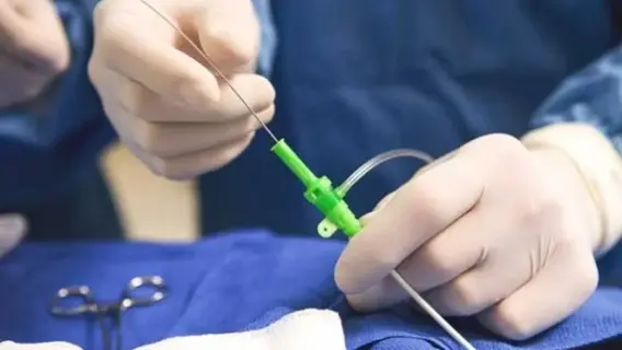 عملية قسطرة قلبية في مستشفى الصحة